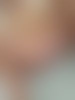 Miniaturka 9 — Lexi_camp