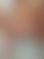 Miniaturka 10 — Lexi_camp