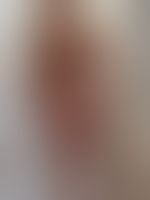 Miniaturka 9 — Lexi_camp