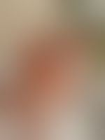 Miniaturka 7 — Lexi_camp