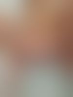 Miniaturka 9 — Lexi_camp