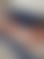 Miniaturka 9 — Lexi_camp