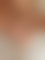 Miniaturka 17 — Lexi_camp