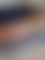 Miniaturka 7 — Lexi_camp