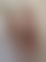 Miniaturka 4 — Lexi_camp