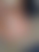 Miniaturka 19 — Lexi_camp