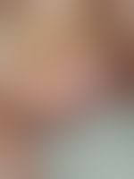Miniaturka 6 — Lexi_camp