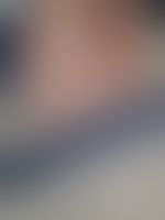 Miniaturka 13 — Lexi_camp