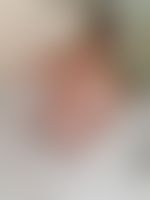 Miniaturka 4 — Lexi_camp