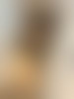 Miniaturka 2 — Ameleeka