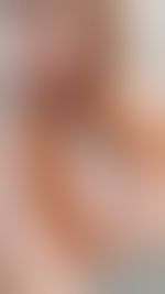 Miniaturka 2 — wolfieredfoxOfficial