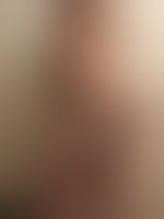 Miniaturka 2 — wolfieredfoxOfficial