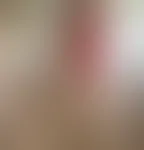 Miniaturka 2 — naaastiaaa